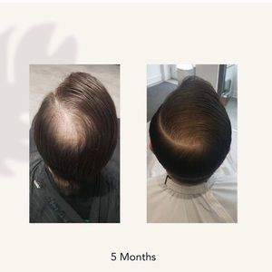 Travel size RECOVER THICKENING SHAMPOO TREATMENT FOR MEN